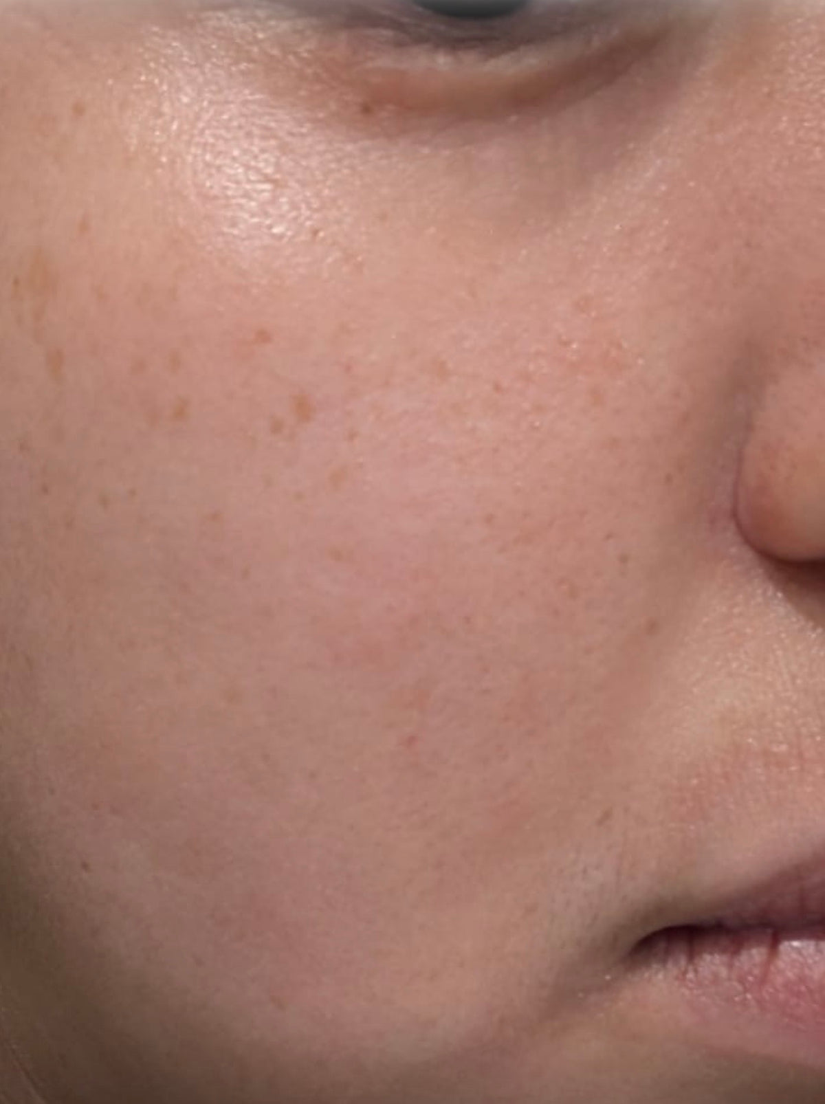 Reactive Skin, 12-Week Programme — after